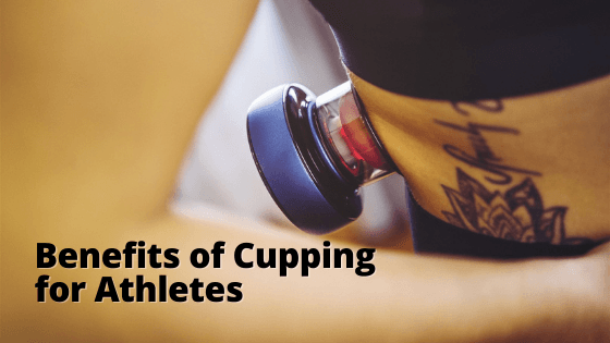 Why Athletes Should Try Cupping Therapy - SourceOrtho