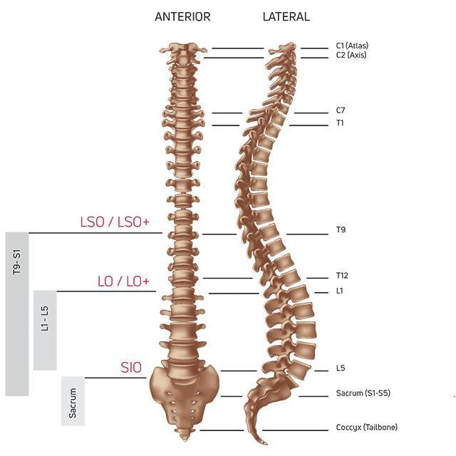 Donjoy ISOFORM LO Back Brace DonJoy Category