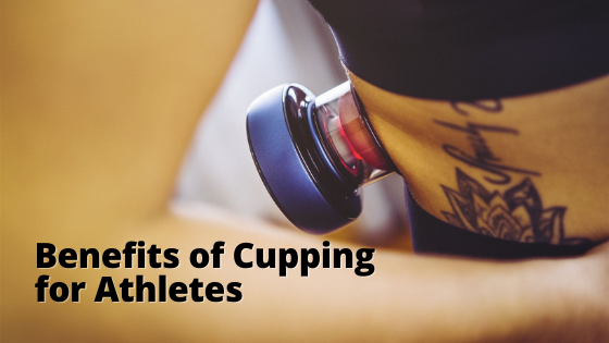 Why Athletes Should Try Cupping Therapy