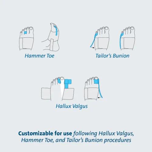 Darco Toe Alignment Splint