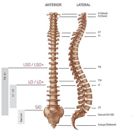 DonJoy ISOFORM® SIO Low-Profile Belt for SI Stabilization 